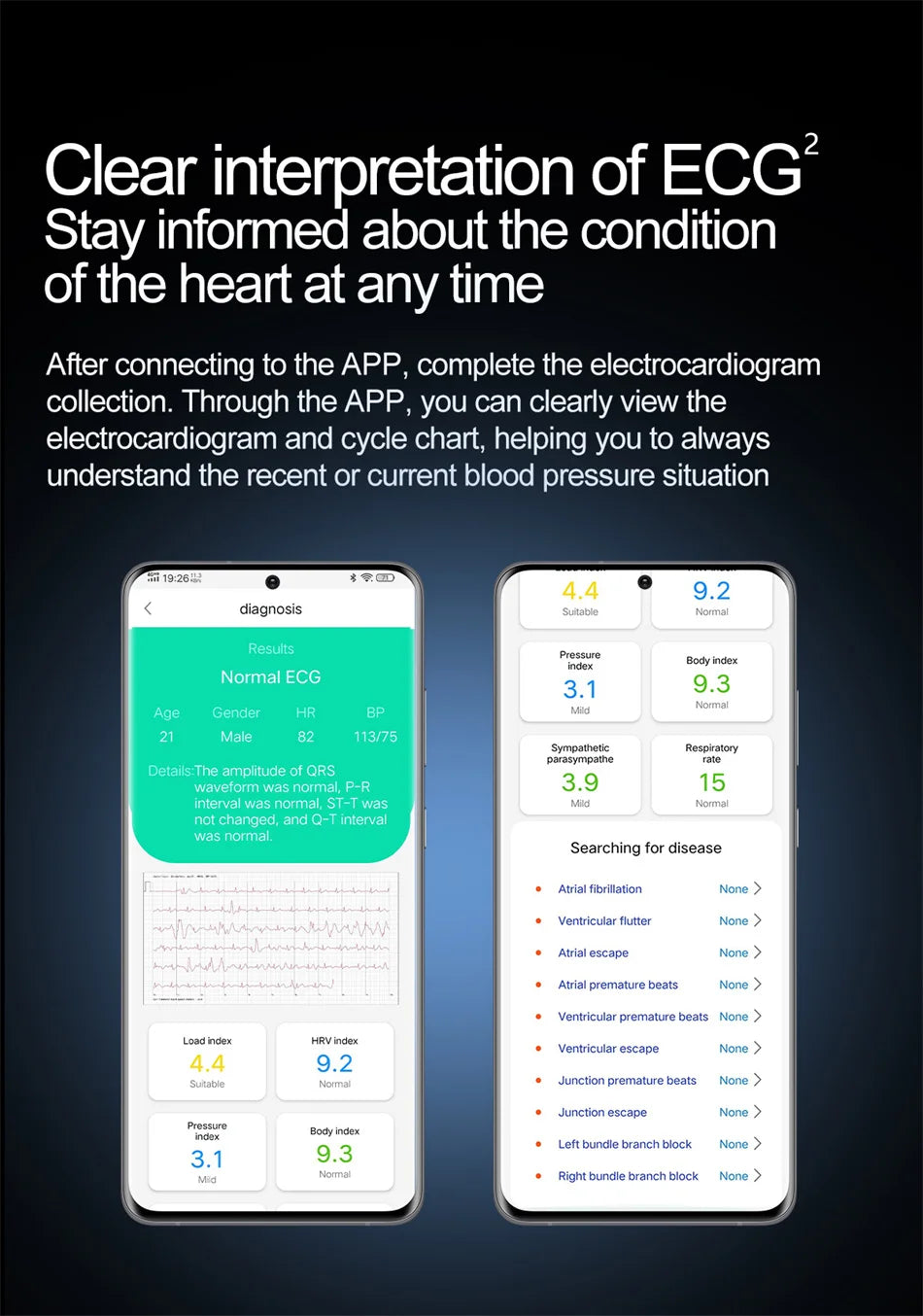 2025 Unisex Gezondheid Smartwatch NFC ECG Luchtpomp Bloeddruk Bloedzuurstof ECG + PPG Bluetooth Bellen NFC Smartwatch Mannen Vrouwen Airbag