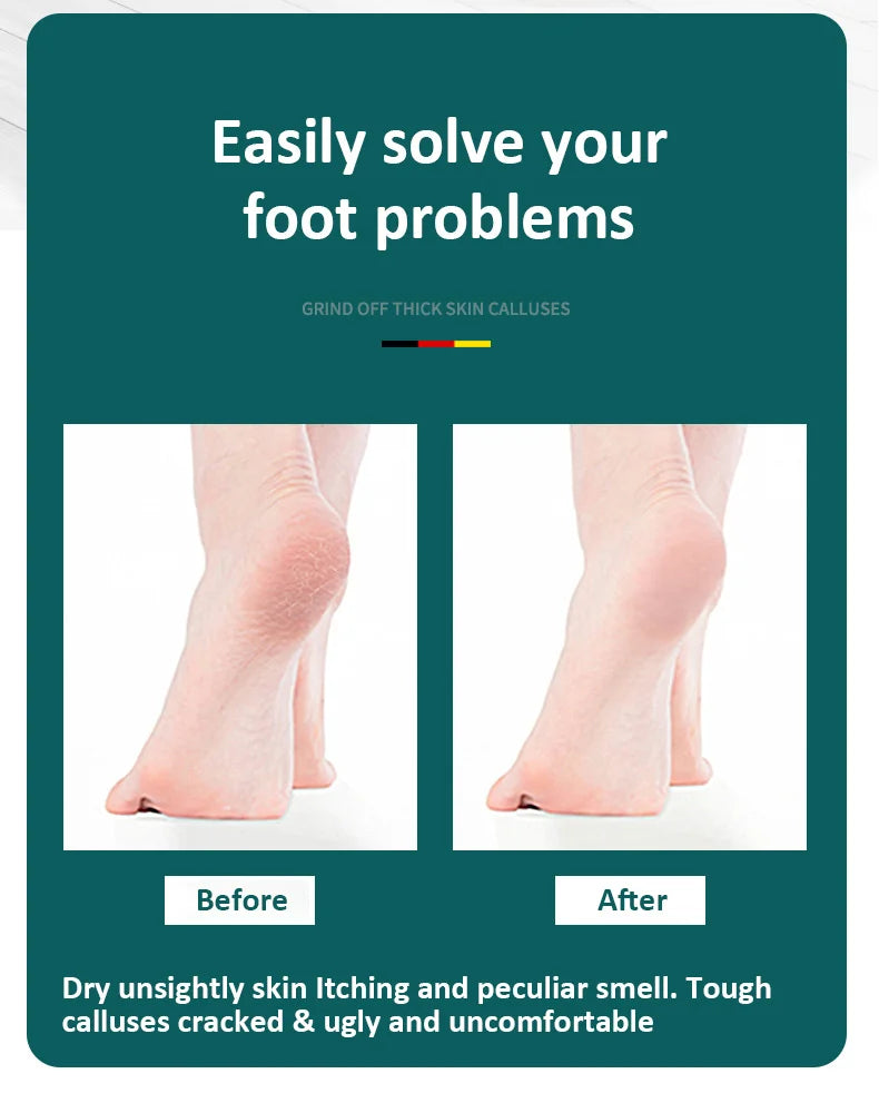 High-Quality 304 Stainless Steel Foot File Double Sided Callus Remover For Dead Skin Professional Pedicure Tools Callous Scraper