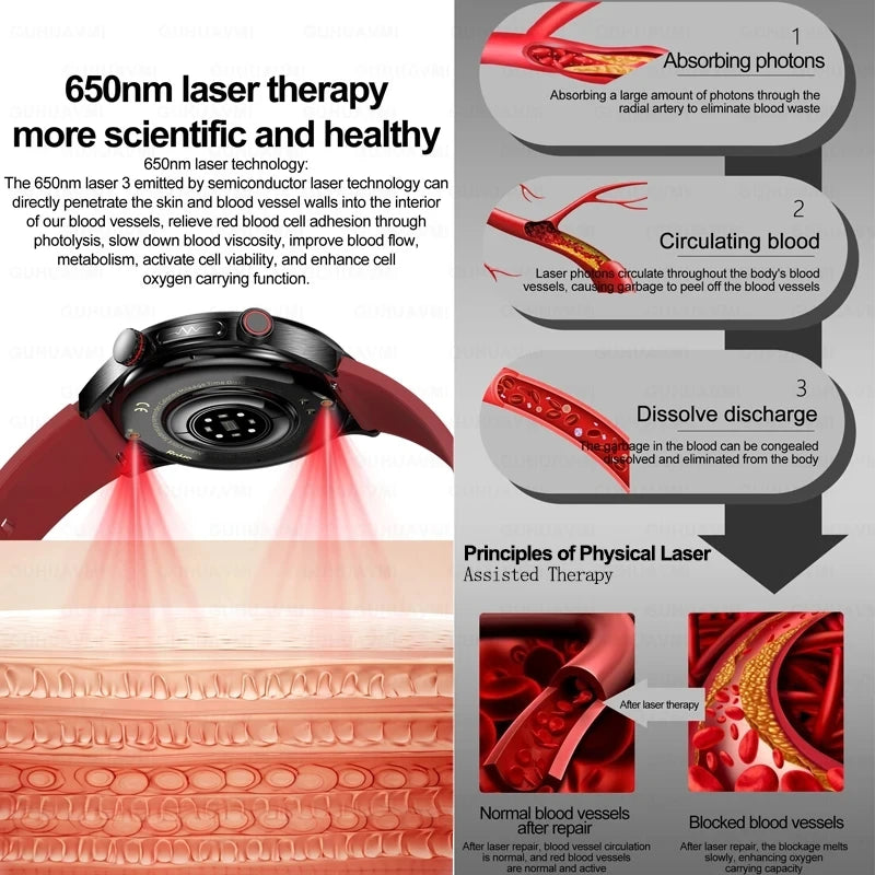 2025 New Smart Watch ECG+PPG Laser Treatment Blood Lipid Heart Rate Blood Pressure Health Sport Smartwatch For Men - Compatible with Huawei & Xiaomi IOS