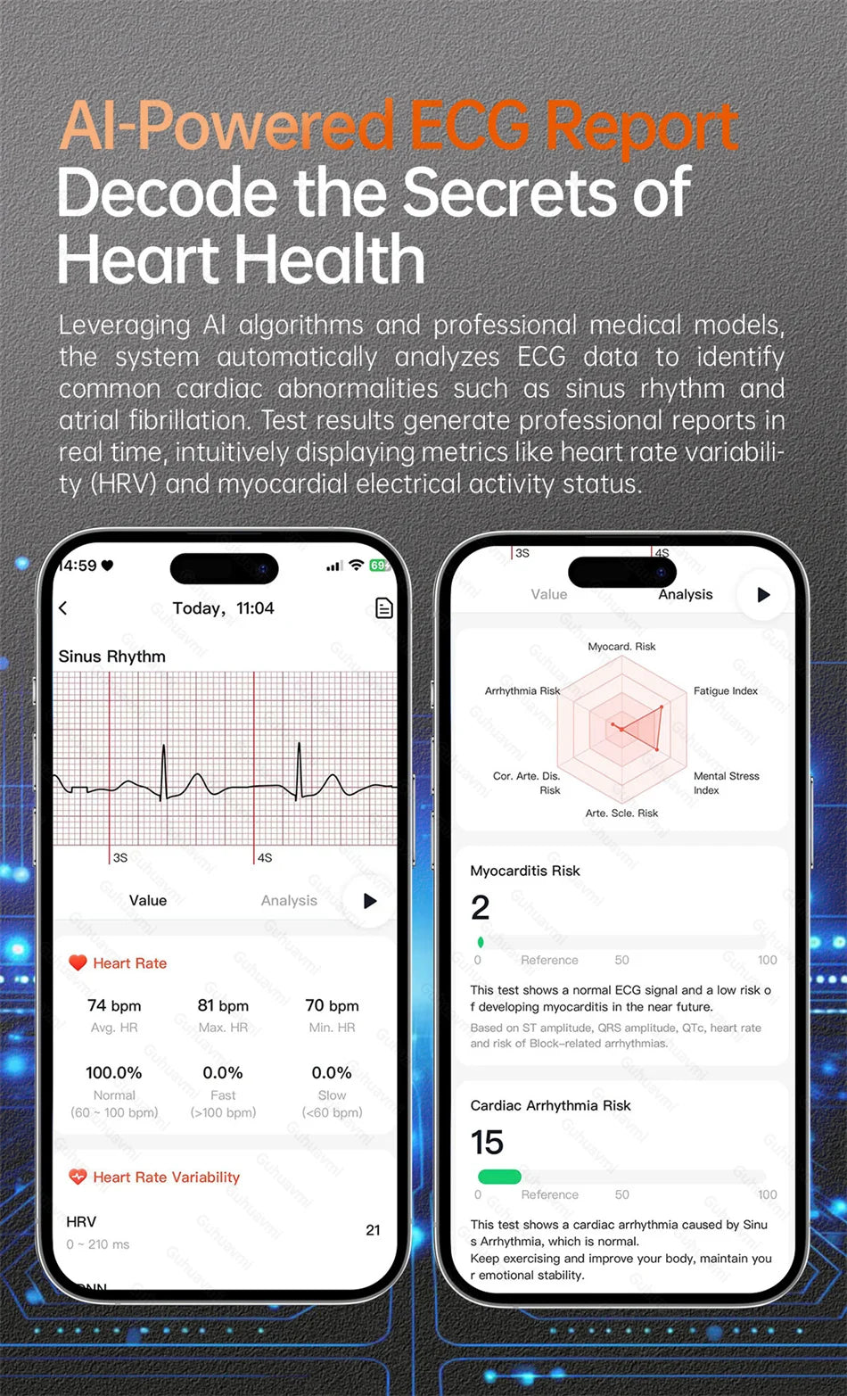 2025 Nieuw Smart Watch NFC ECG+PPG Bloedzuurstof Urinezuur Bloeddruk Saffier Smartwatch Heren - Compatibel met Samsung Galaxy, Xiaomi en Huawei IOS