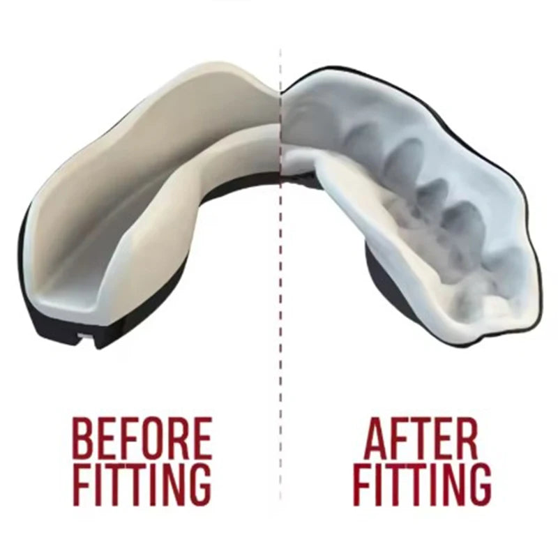 Kids & Youth Sports Mouth Guard – MMA, Boxing & Taekwondo Dental Protection Guard for Combat Training